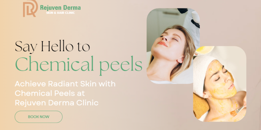 Chemical Peels