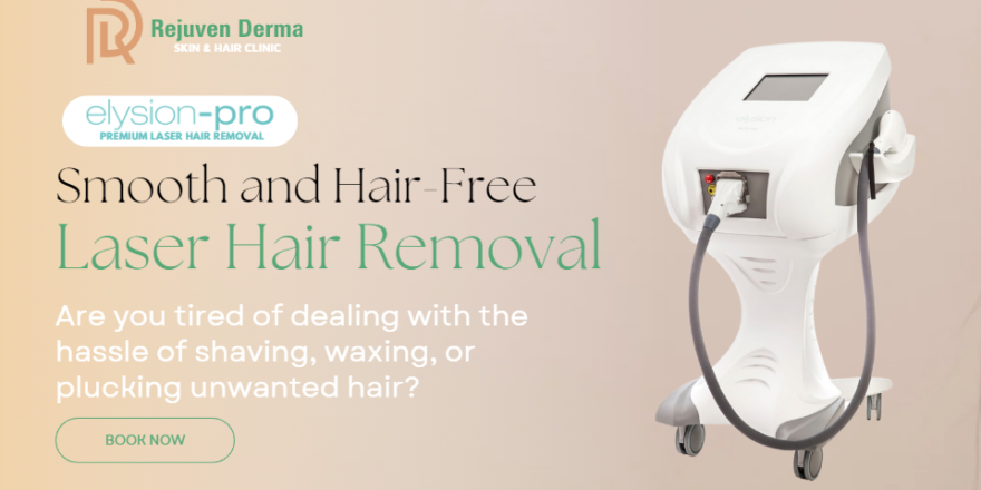 laser hair removal