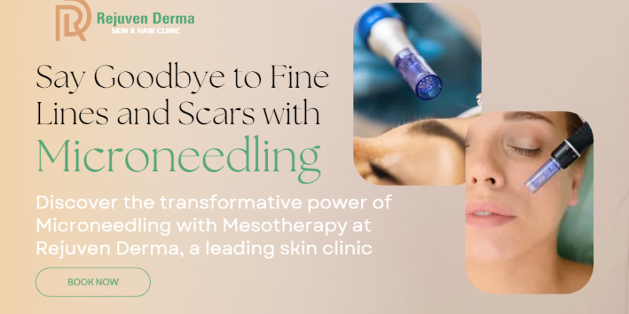 Microneedling