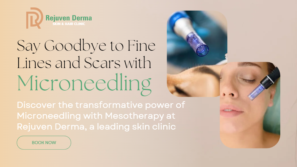 Say Goodbye to Fine Lines and Scars: Microneedling (with Mesotherapy) at Rejuven Derma