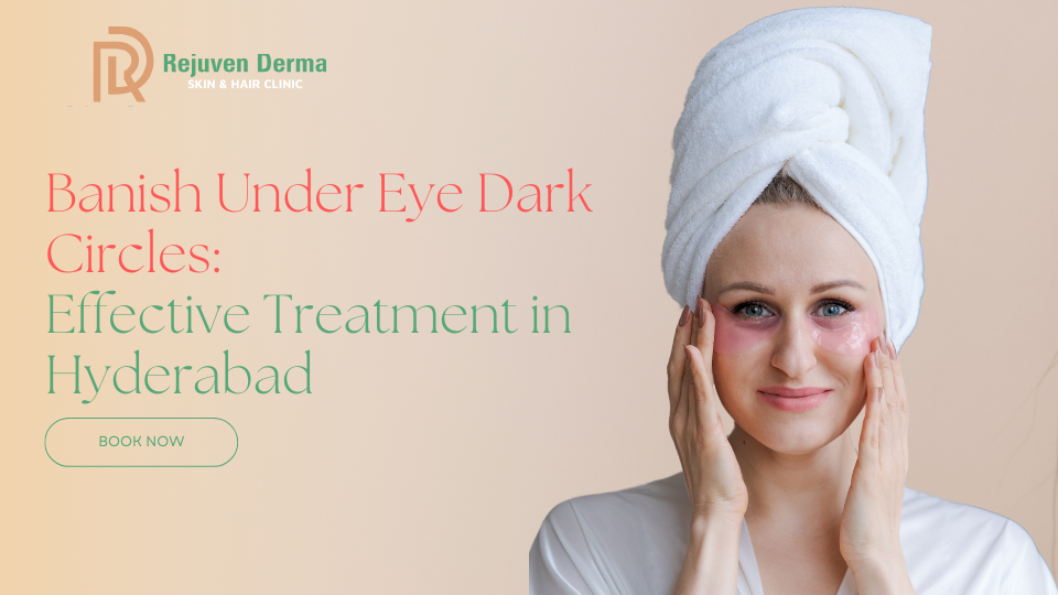 Banish Under Eye Dark Circles: Effective Treatment in Banjara Hills, Hyderabad